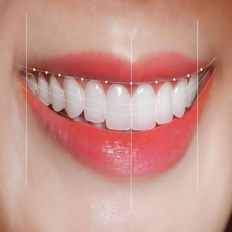 Cung răng đẹp