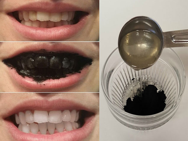  Cách làm răng trắng với bột than hoạt tính