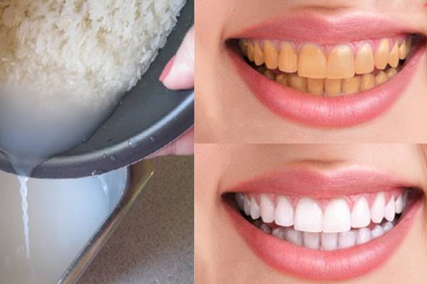 Cách làm trắng răng tại nhà với nước vo gạo