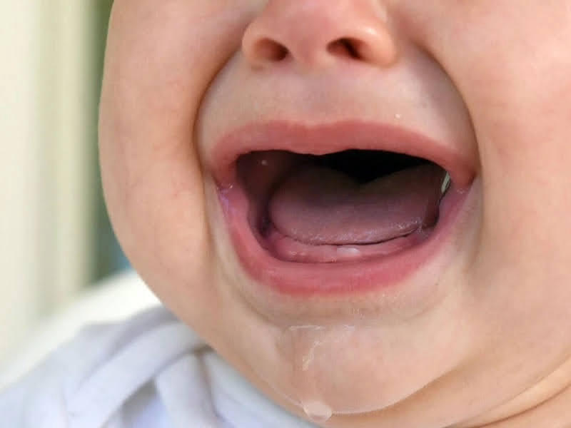 Dấu hiệu nhận biết trẻ mọc răng