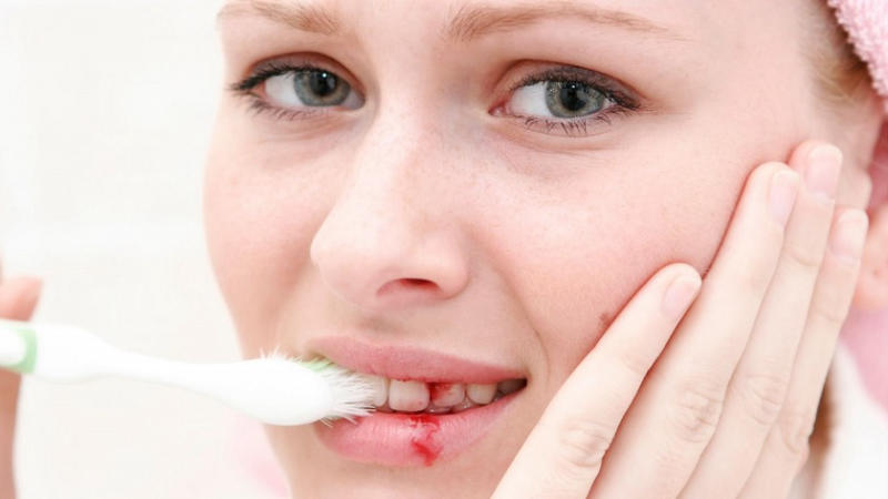 Ê buốt răng do đánh răng không đúng cách