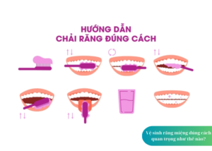 vệ sinh răng miệng đúng cách