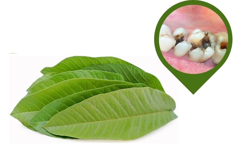 Mẹo chữa đau răng bằng lá ổi Mẹo chữa đau răng bằng lá ổi