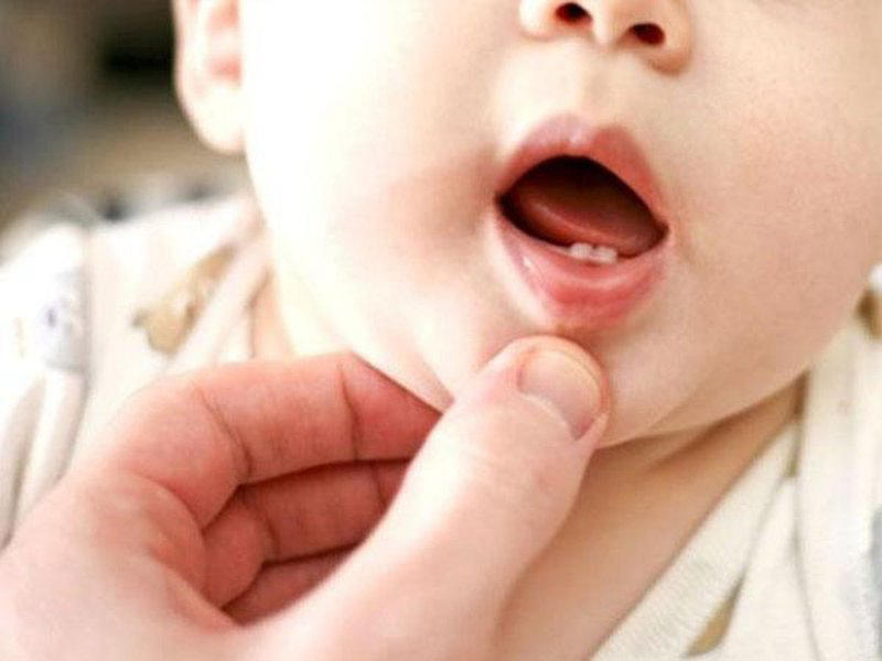 Những lưu ý cần biết về sốt mọc răng ở trẻ.