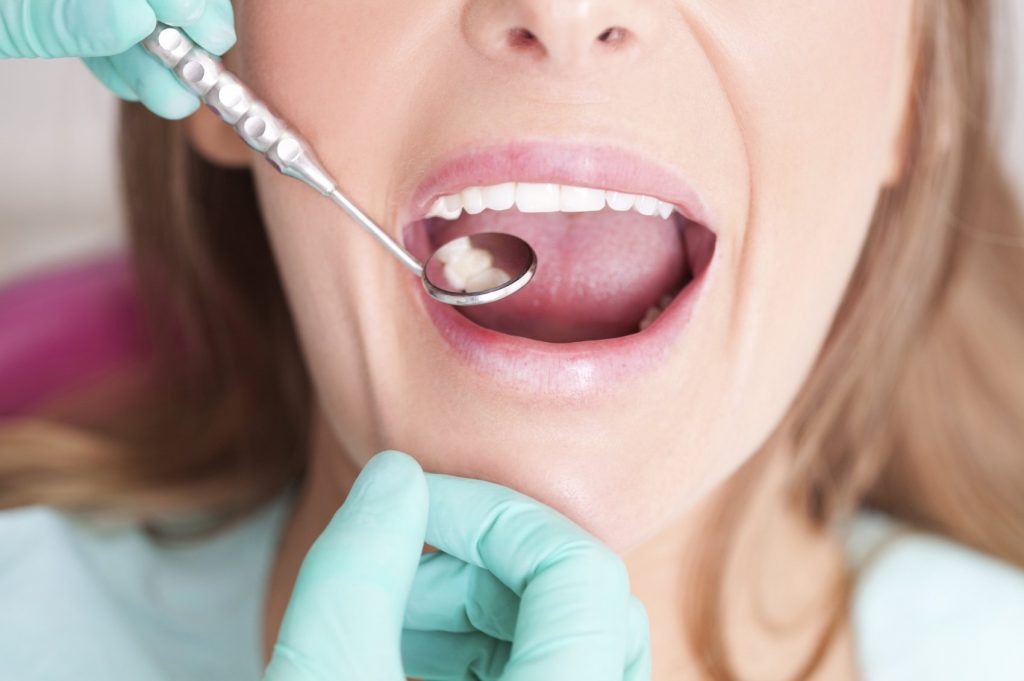 Phòng ngừa một số bệnh lý gây hại cho răng miệng của bạn
