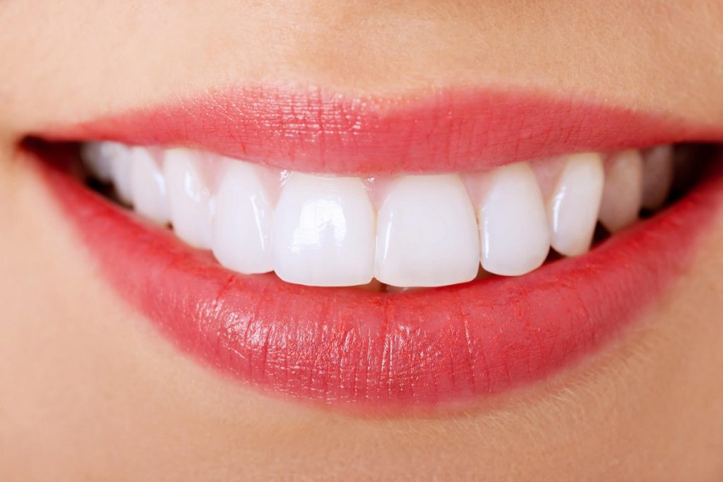 Sở hữu hàm răng trắng bóng, phòng ngừa nguy cơ bị sâu răng 