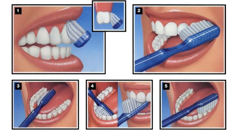  Cách vệ sinh răng miệng đúng cách 