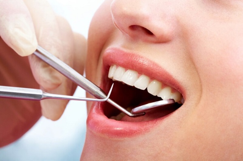 Tại sao cần loại bỏ răng khôn hàm trên?