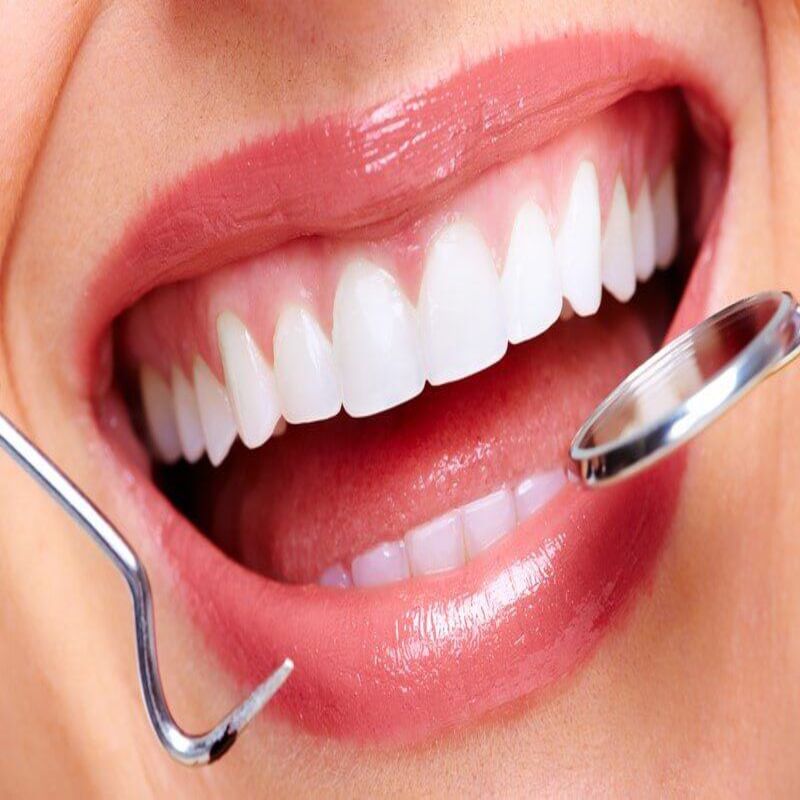 Biến chứng nguy hiểm có thể gặp sau khi nhổ răng? 