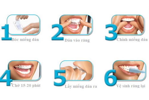 Cách dùng miếng dán trắng răng