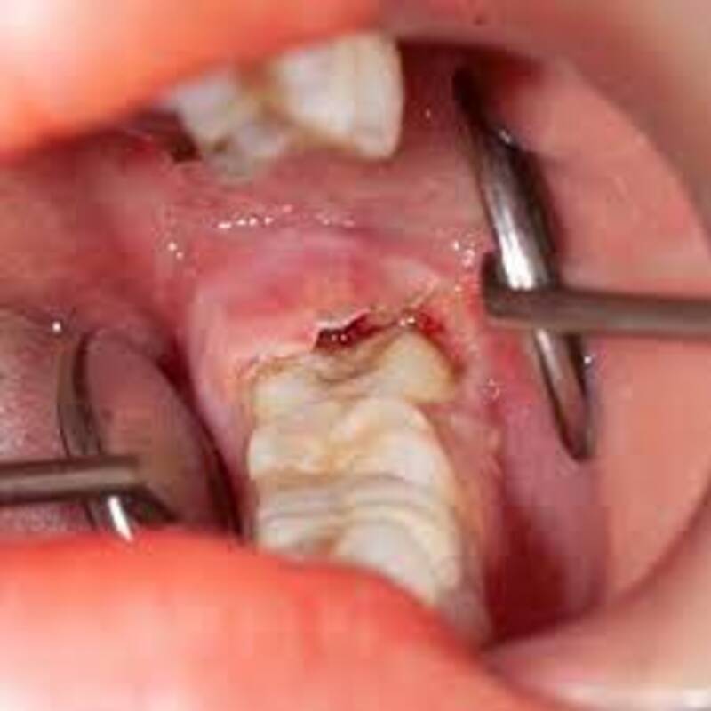 Kiểm tra và chẩn đoán tình trạng răng
