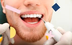 Lấy vôi răng có đau không? 