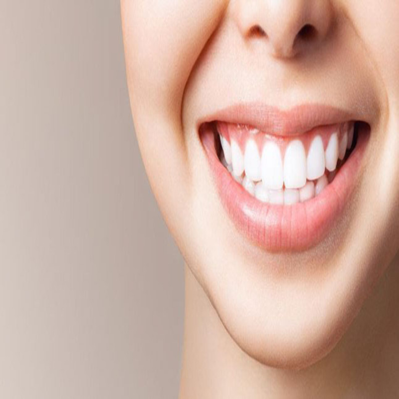 Hàm răng chuẩn đẹp dựa trên những yếu tố nào