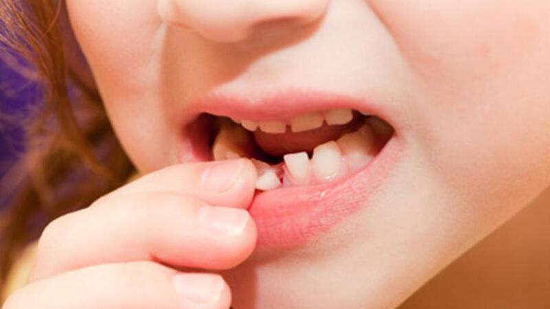 Dự báo về giấc mơ thấy rụng răng hàm dưới không bị chảy máu 