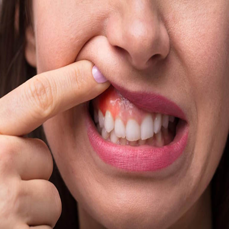 Ngăn ngừa được các bệnh lý về răng miệng