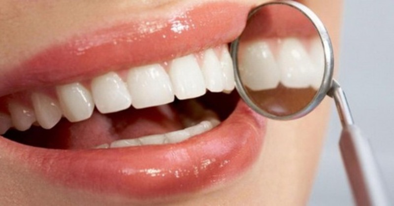 Bước 4: Kiểm tra kết quả răng miệng 