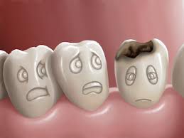 Trẻ em 3-4 bị sâu răng là do đâu và cách điều trị