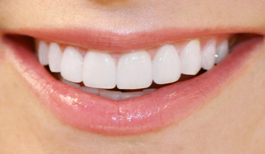 Thế nào là hàm răng đẹp tự nhiên