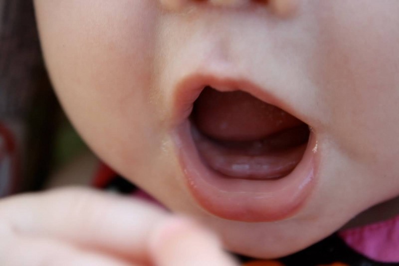 Lịch mọc răng của trẻ như thế nào?
