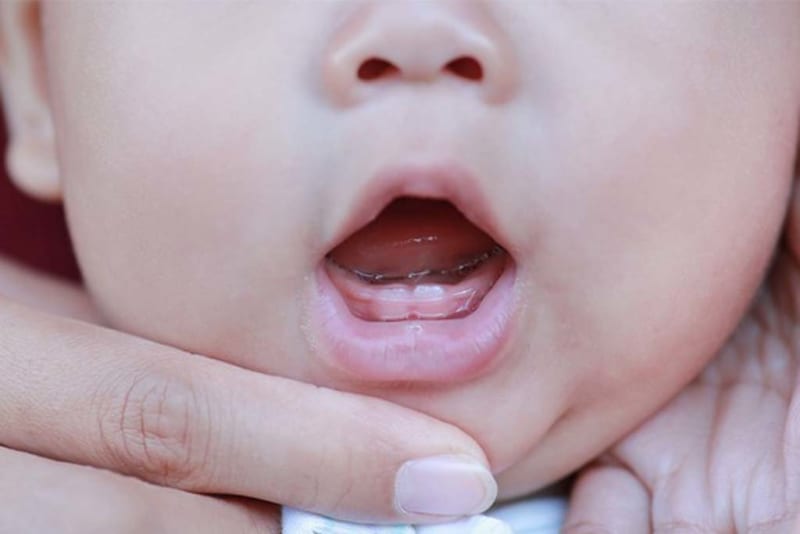  Vệ sinh răng miệng giúp trẻ 