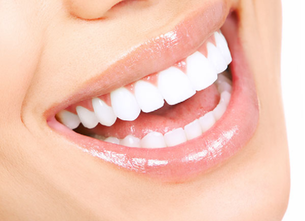  Các yếu tố ảnh hưởng đến chi phí bọc răng sứ 