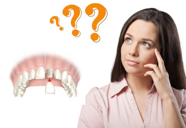  Các yếu tố giúp kéo dài tuổi thọ của răng sứ? 