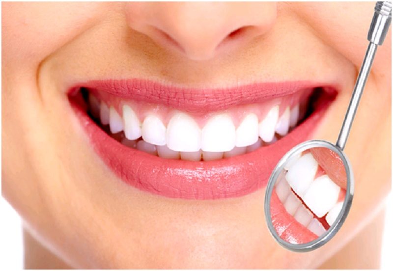  Cách làm răng sứ được diễn ra thế nào? 
