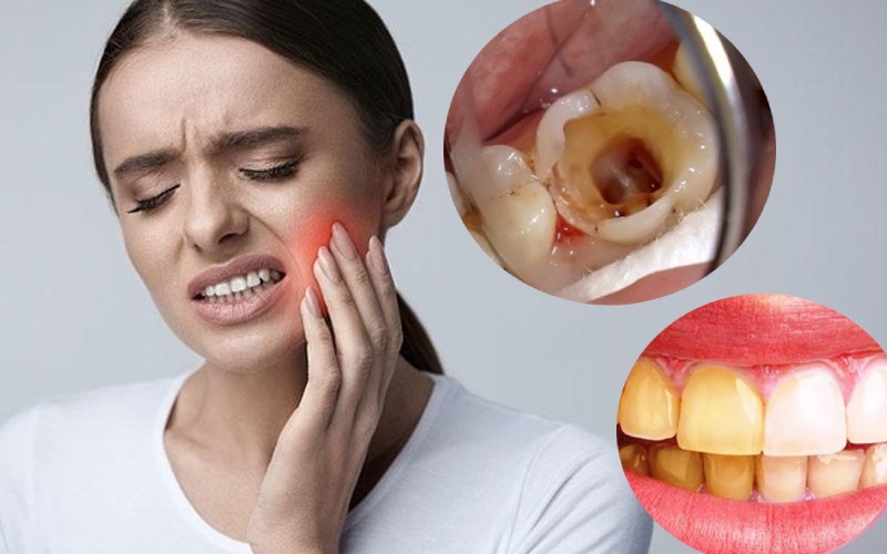 Những nguyên nhân gây ra các tác hại của bọc răng sứ