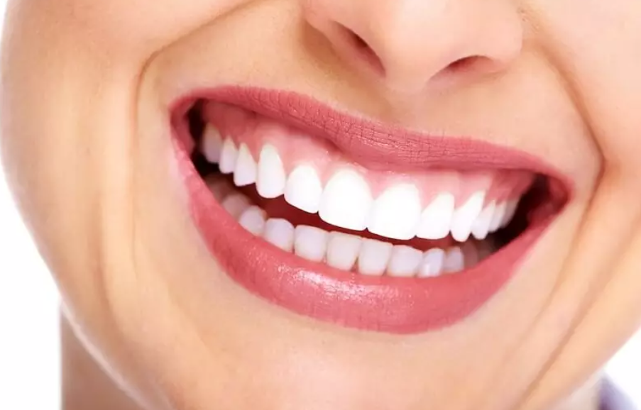 Phương pháp trồng răng sứ thẩm mỹ thường sẽ phù hợp với những ai?