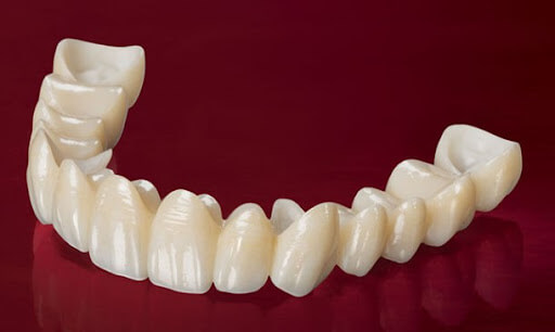Tại sao lại có dịch vụ bọc răng sứ giá rẻ tại nha khoa?