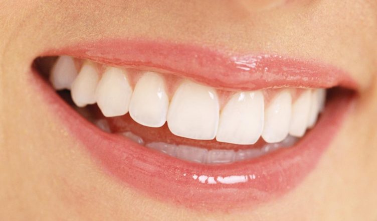  Làm sao có thể duy trì độ bền răng sứ được qua nhiều năm?
