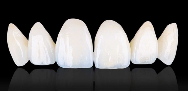 Cấu trúc của răng sứ Cercon