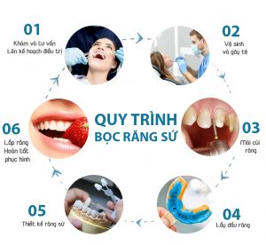 Quy trình Bọc răng sứ Lisi