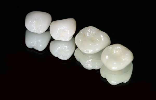 răng sứ ceramill-ưu điểm khi bọc răng sứ Ceramill 4 ưu điểm khi bọc răng sứ Ceramill