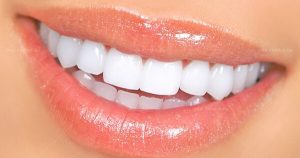 Các đối tượng nào nên dùng răng toàn sứ DDBIO?