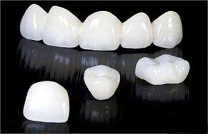 So sánh răng sứ HT Smile với các loại răng sứ khác