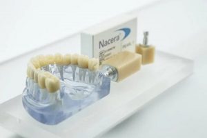 Cấu tạo răng sứ Nacera