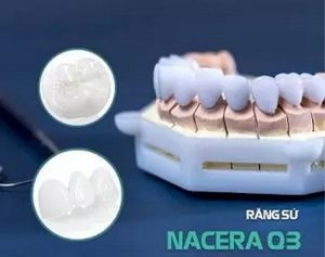 Răng sứ Nacera Pearl Q3 Multi-Shade