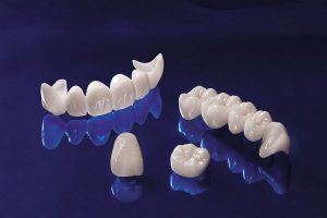 Cấu tạo của răng sứ thẩm mỹ bao gồm?