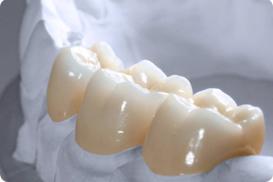 Quy trình bọc răng sứ Đức Zirconia
