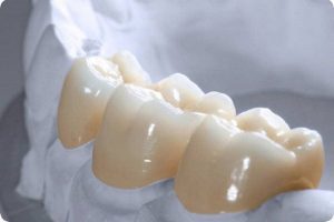 Răng sứ cao cấp Zirconia
