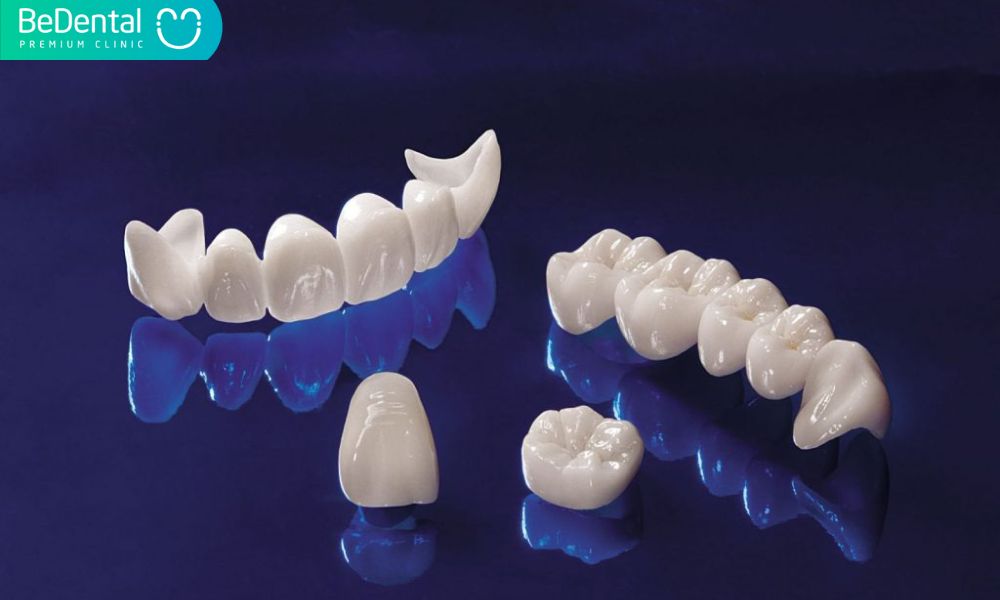 Những trường hợp nào nên bọc răng sứ Cercon?