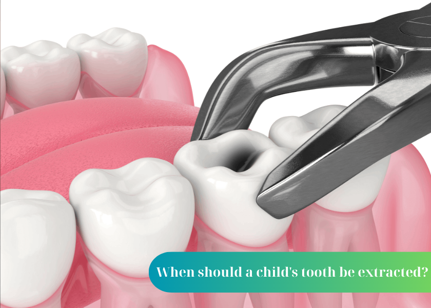 Can children's teeth be replaced?