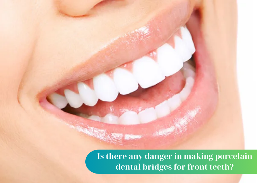 Should I get a porcelain bridge for my front teeth or not? Is it good to make porcelain dental bridges for front teeth? Process of making porcelain dental bridges