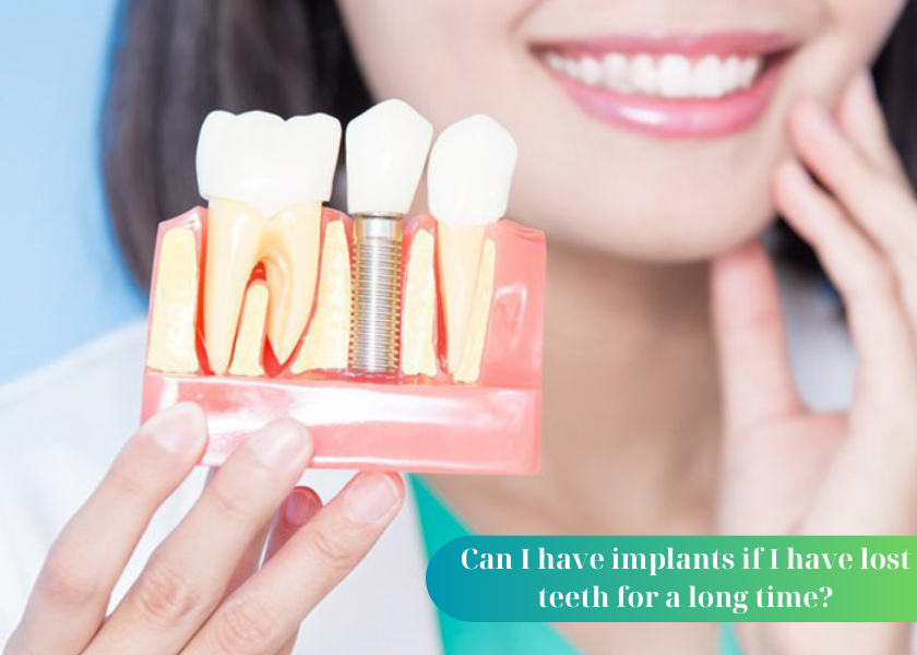 How long after tooth extraction can I get an implant?