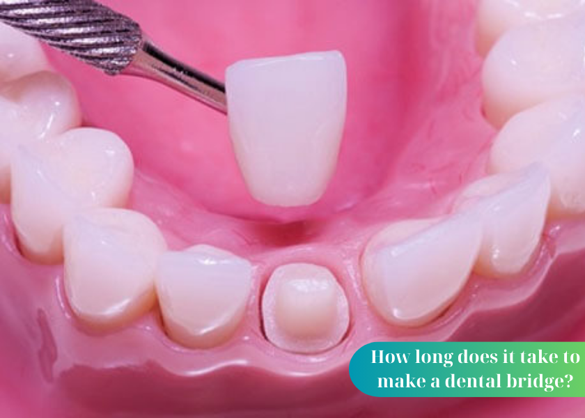 Does porcelain dental bridge cause bone loss?
