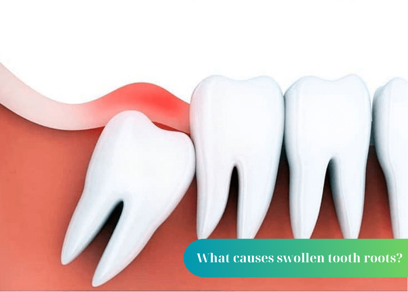 What causes swollen tooth roots?