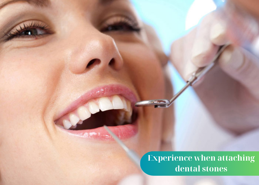 Experience when attaching dental stones
