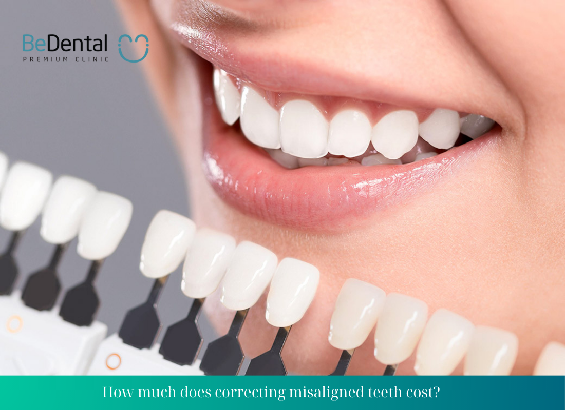 cost of fixing misaligned teeth 3