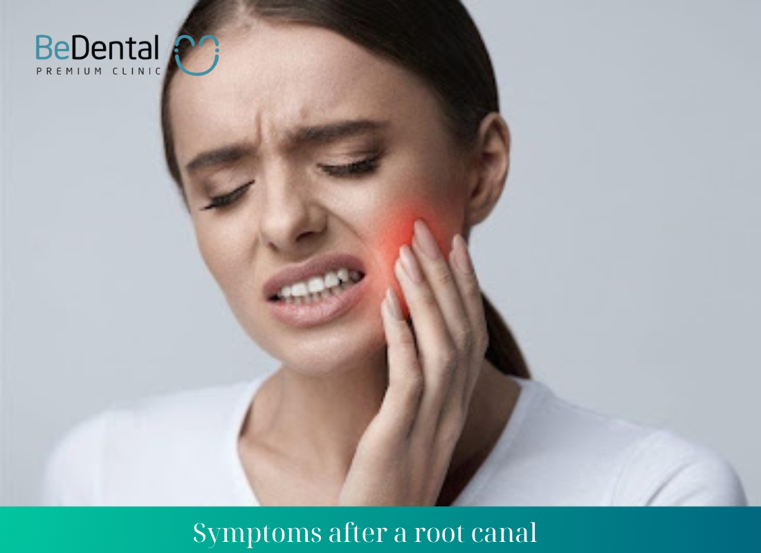 root canal symtoms